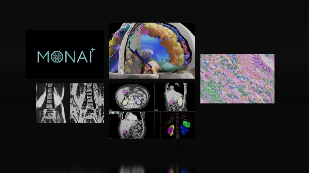 엔비디아, 서울대학교병원 공동으로 ‘HCLS 서밋 코리아 2023’ 개최 (2).jpg