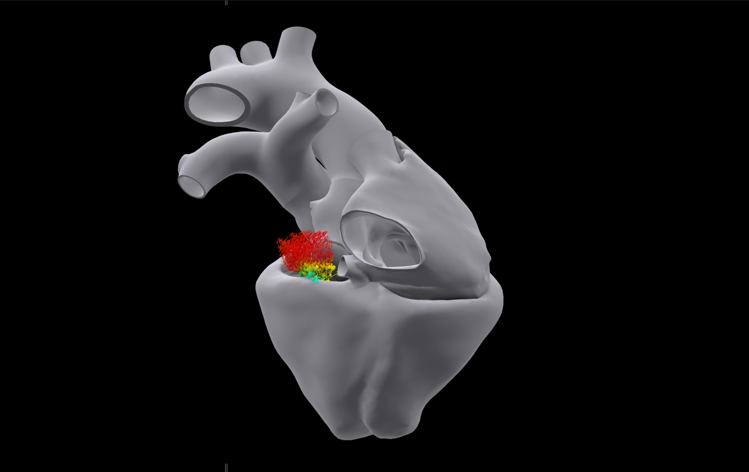 다쏘시스템 협업으로 임상시험 내 버추얼 트윈 사용 위한 획기적인 가이드 발표_3.jpg