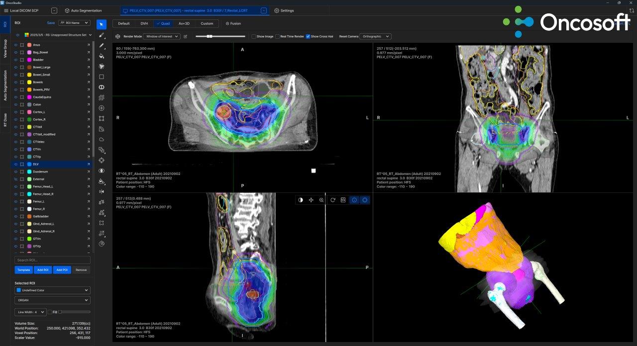 Qt그룹, 온코소프트에 Qt 플랫폼 활용한 ',OncoStudio 2.0', 고도화 지원…의료 AI 시장 공략 강화.jpg
